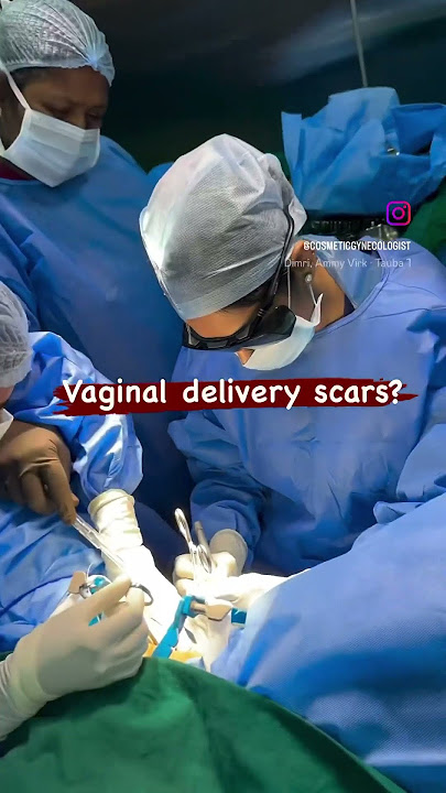 Vaginal delivery scar removal / Dr. Deepa Ganesh / Cosmetic Gynecologist