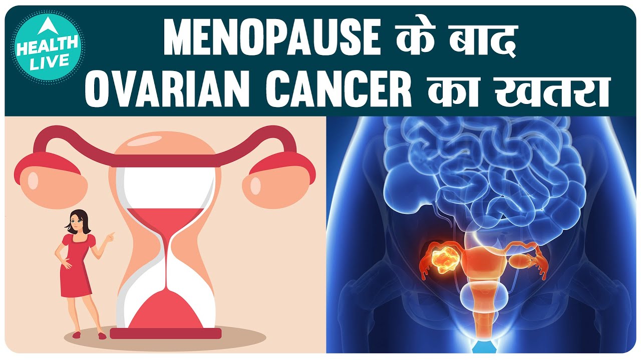 Ovarian Cancer After Menopause Lifestyle After Menopause Warning Ovarian Cancer After Menopause Lifestyle After Menopause Warning