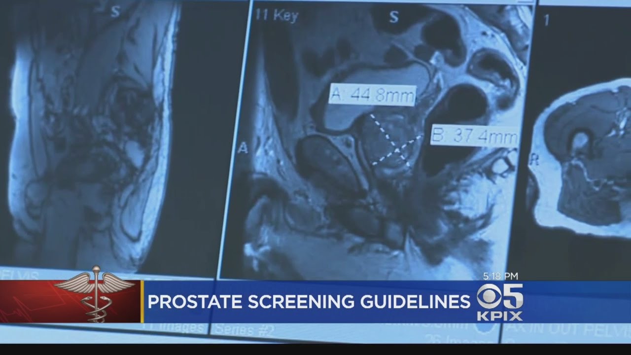 Screening For Prostate Cancer Has Risks, And Benefits