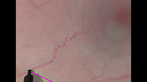 Penetrate the surface 0.1mm with chance constraint