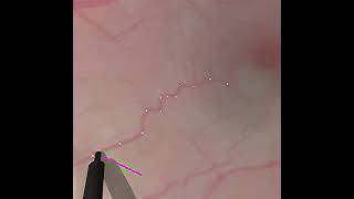 Penetrate the surface 0.1mm with chance constraint