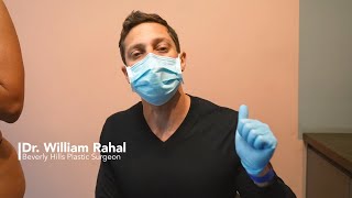 Skin Tightening with Lipo 360 and BBL | Before and After |  7 Months Post-op | Age: early 50’s
