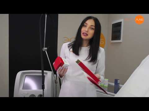 Почему появляется пигментация и как с ней бороться