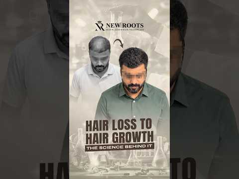 Hair Transplant in Pune | Best Hair Transplant Clinic in Pune | New Roots #hair #shorts #ytshorts