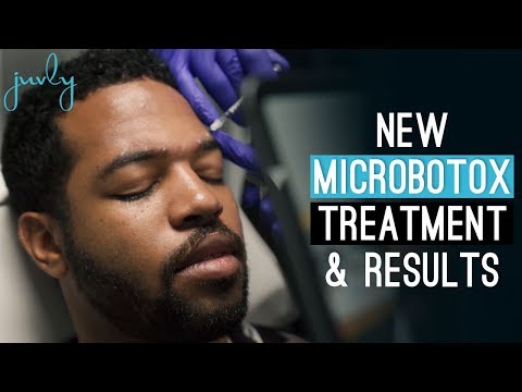 Micro Botox Technique with Dr. Justin Harper and his Expert Team