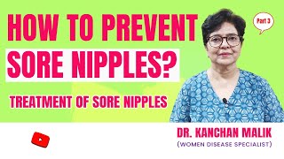 How To Prevent And Treat Cracked/ Sore Nipples: Dr Kanchan Malik