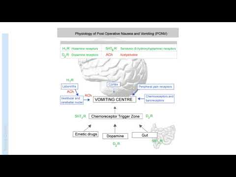 Post Operative Nausea and Vomiting (PONV) | Anaesthesia