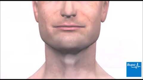 Upper GI endoscopy animation