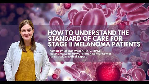 How to Understand the Standard of Care for Stage II Melanoma Patients