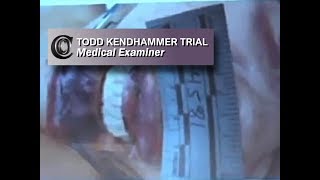 TODD KENDHAMMER TRIAL - 👩‍⚕️ Medical Examiner (includes head images) (2017)
