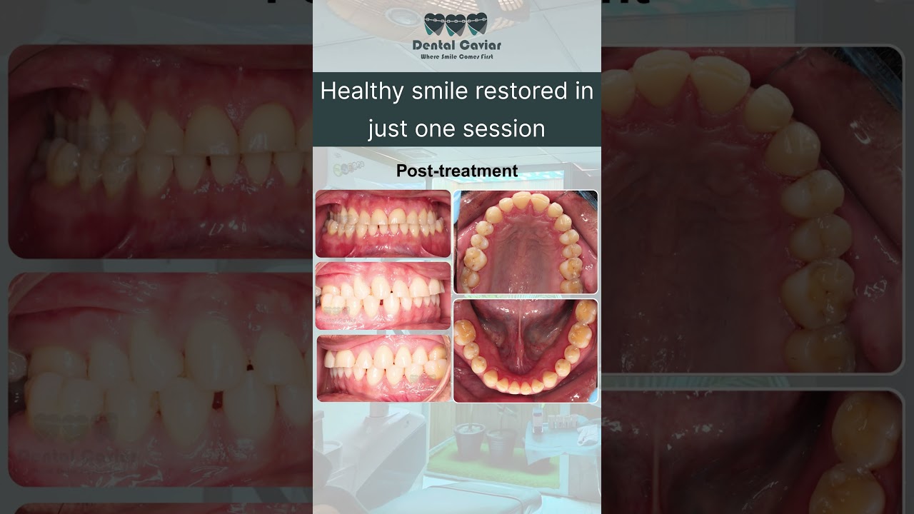 Best cosmetic dentist in Multan/ Best dental clinic in Multan/ Best dentist in Multan