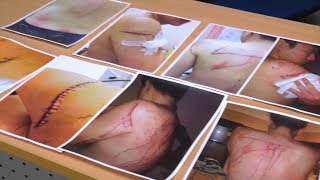 Taiwanese robbed and stripped naked after meeting WeChat friend