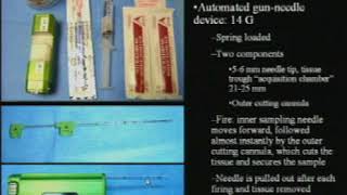 Image Guided Biopsies   A Clinical Review