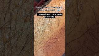 Sweat it out… Skin heals naturally  #viral #telugu #aa23 #sweat #reels #shrots #youtubeshorts
