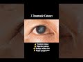 Don't miss this in OPD 👁 🗣 #optometry #eyes #mbbs #doctor #ophthalmology #shorts