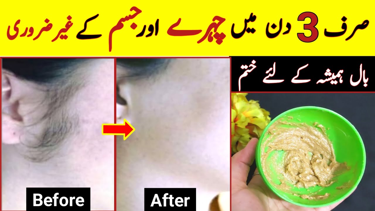 Best Remedy For Facial And Full Body Unwanted Hair Permanently Remove