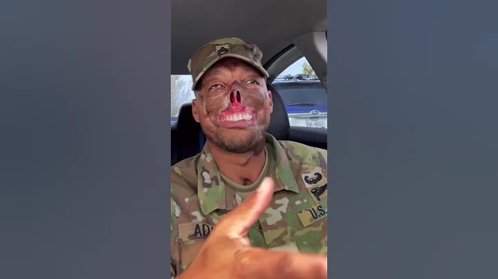 Burn Soldier Randy Adams Story #shorts