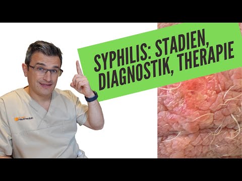 SYPHILIS: STADIEN, DIAGNOSTIK, THERAPIE. Basiswissen für die Facharztprüfung Dermatologie.