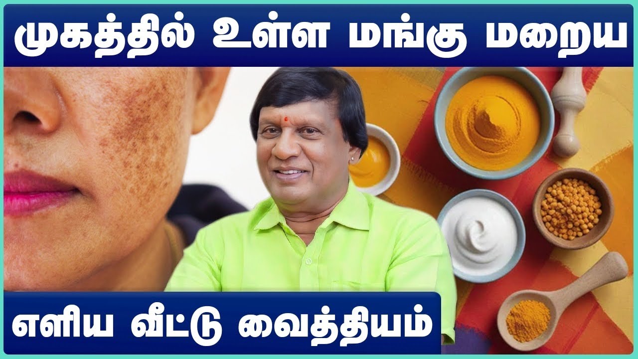 Skin pigmentation home remedies | மங்கு மறைய டிப்ஸ் | Dr.Anbu Ganapathi | Cosmo Health