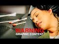 WARNING! GRAPHIC CONTENT // The Migraine Daith Piercing | Vlog