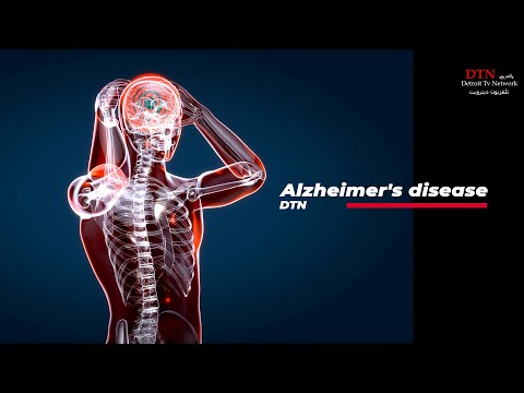 علاج جديد لمرض الزهايمر الخرف او فقدان الذاكرة   