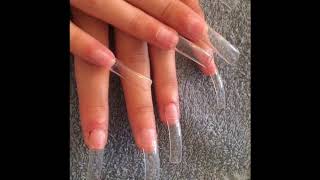 Tipsi Dirnag Qaynagi Nece Edilir?