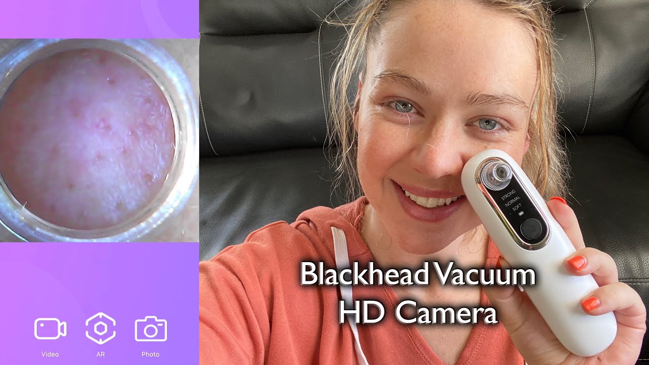 LEVETOP Wireless Visual Blackhead Vacuum Review YouTube