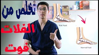 أفضل تمارين للتخلص من الفلات فوت | flat foot exercise