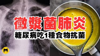 糖尿病可以吃什麼食物？抵抗病菌必吃的食物