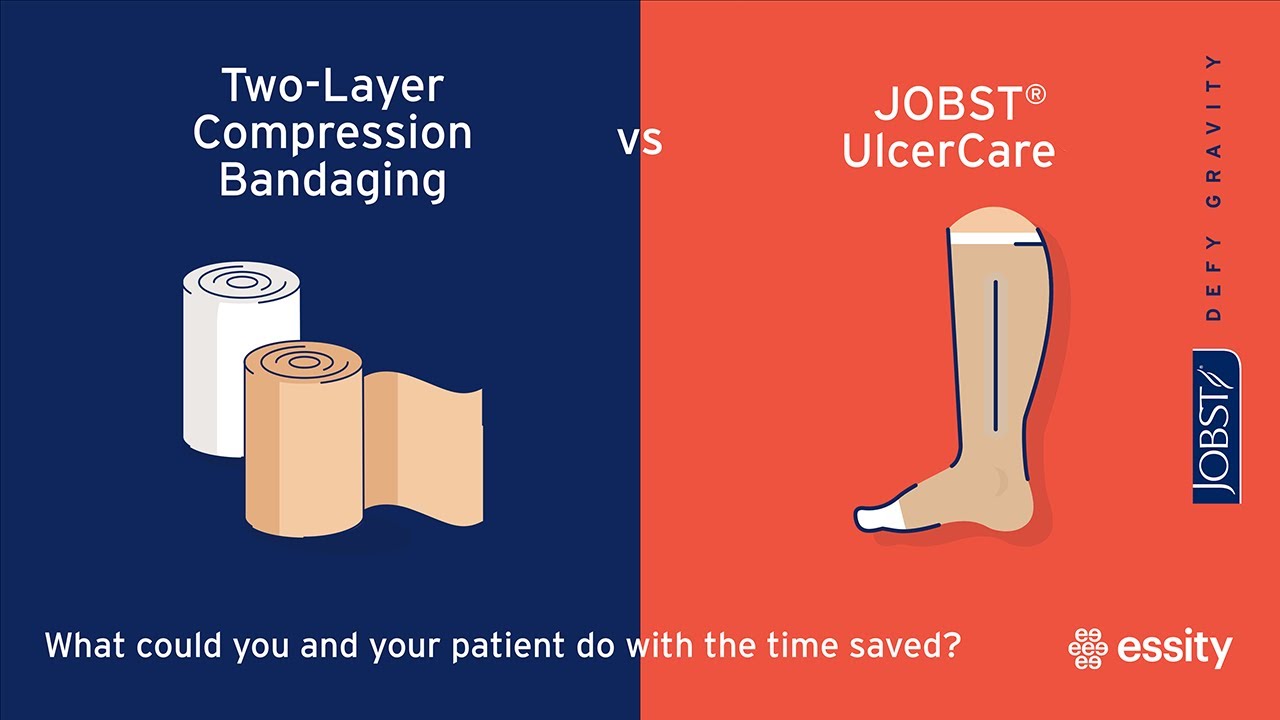 JOBST STEP: Compression bandaging alternatives may save nursing time when treating venous leg ulcers