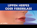 LIPPEN HERPES – Was ist eine Fieberblase und wie wird sie übertragen? ©