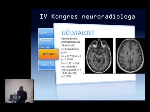 Neuroradiološki i neuroanatomski korelati shizofrenije   Branislav Filipovic