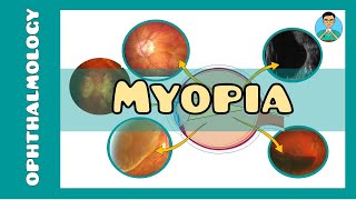 Myopia | What is Myopia (Short sightedness)? | What is the main cause of myopia? | myopia treatment