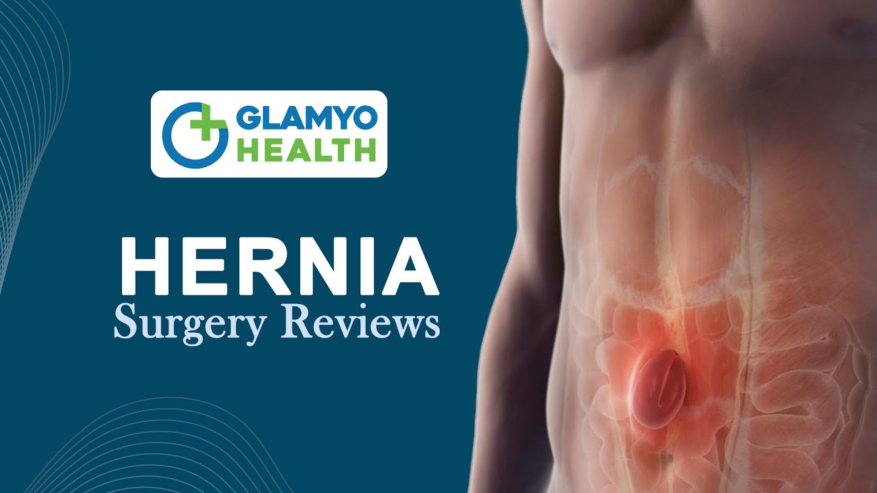 Hernia Patient Review - Glamyo Health