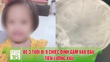 BÉ 3 TUỔI BỊ 9 CHIẾC ĐINH GĂM VÀO ĐẦU TIÊN LƯỢNG XẤU | VTC16
