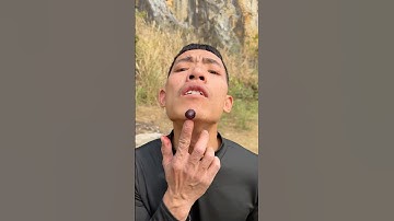 How I Treated Bug Bites with Yogurt in the Wild | Survival Tips