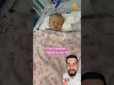 CIRROSIS
