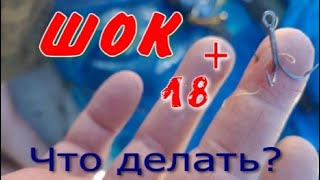 Шок 18+ что делать?