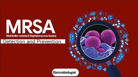 MRSA | All you need to know about methicillin resistant staphylococcus aureus Detection