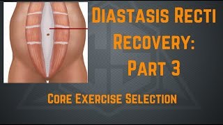 Diastasis Recti Recovery Part 3: Core Exercise Selection