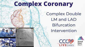 Complex Double LM and LAD Bifurcation Intervention - April 16, 2019