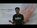 Grade 8 General Science Unit 4 4 1 3 Major Skin Disease And Disorders Part 5 