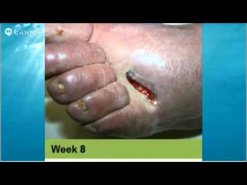 causes-of-diabetes-diabetes-kills-causes-of-diabetes