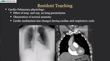DDR as a Resident Teaching Tool | Konica Minolta Healthcare