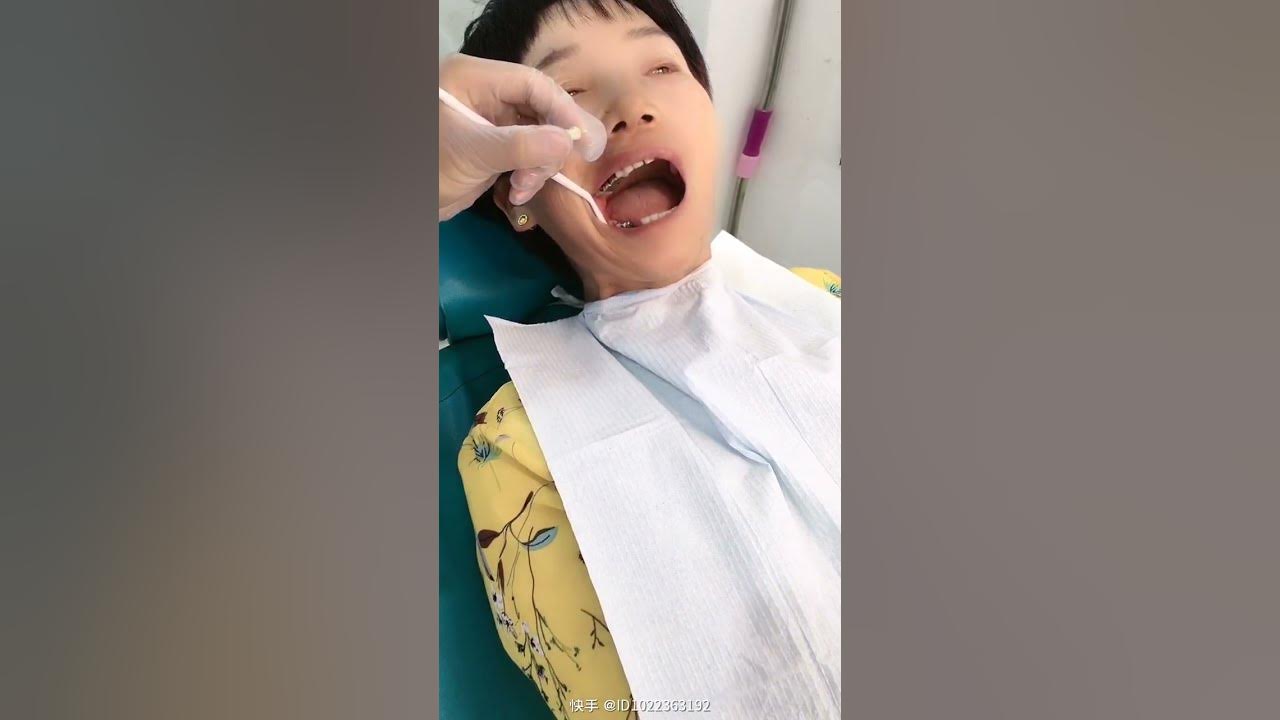 Tooth Filling Cuspid Tooth Extraction Teeth Expander Process