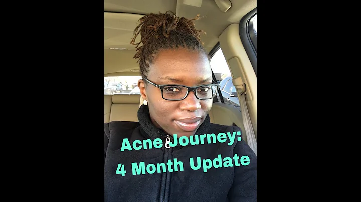 Clearing My Acne Journey: Month 4 Update