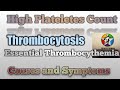 Thrombocytosis in Hindi ll High Platelet Count ll Essential Thrombocythemia ll Hematology