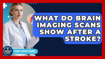 What Do Brain Imaging Scans Show After A Stroke? - Stroke Support Channel