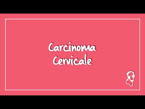 Video: È stato collegato al cancro cervicale?