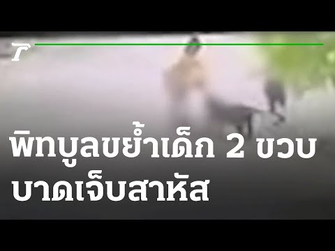 พิทบูลขย้ำเด็ก 2 ขวบเจ็บสาหัส | 22-06-65 | ข่าวเช้าหัวเขียว